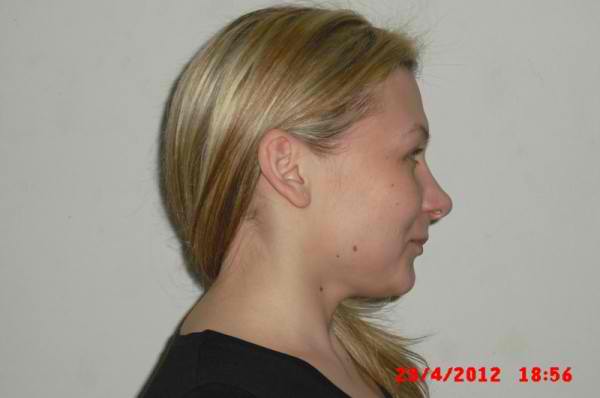 rosida-aids-lesvosnews-2