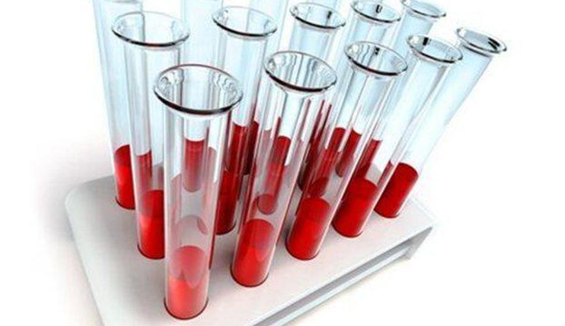 Η ομάδα αίματος συνδέεται με τις καρδιοπάθειες