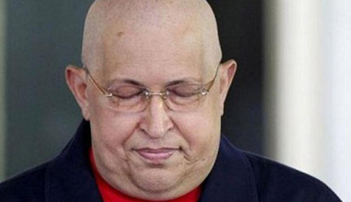 Σε κώμα έχει πέσει ο πρόεδρος της Βενεζουέλας Ούγκο Τσάβες