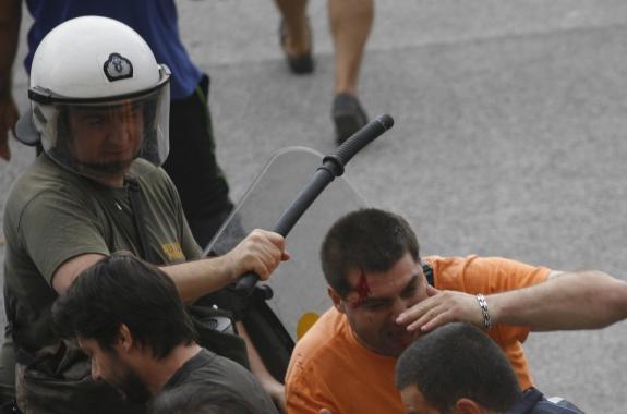 Γκλοπ γυρισμένο ανάποδα καταλήγει στο κεφάλι απλήρωτου εργαζόμενου 