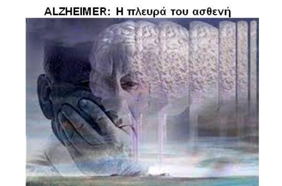 ALZHEIMER: Η πλευρά του ασθενή - Γράφει η Ειρήνη Χατζηαναγνώστου