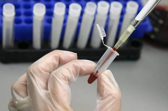 Εβδομάδα δωρεάν ελέγχου δυσλιπιδαιμίας 21-25 Οκτωβρίου